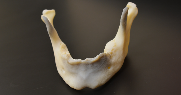 3D Printed Mandible