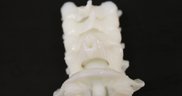3D Articulated Spine