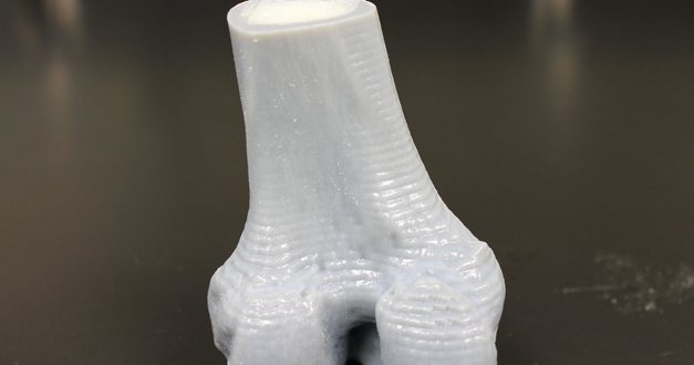 Printed 3D Knee