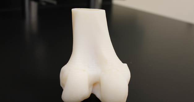 3D Knee Model