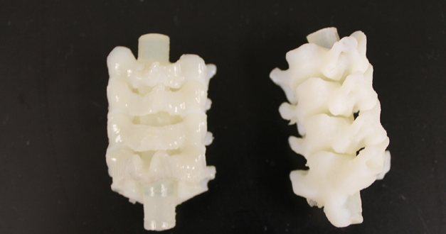 3D Articulated Spine