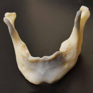 alt="jaw bone"
