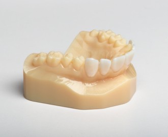 3D Printed Teeth Model
