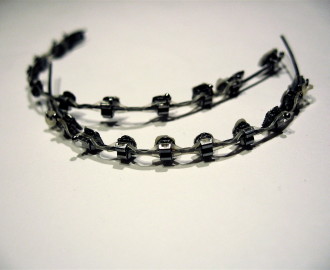3D Printed Dental Braces