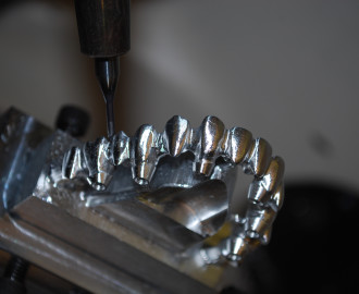 cad/cam software dental bridge